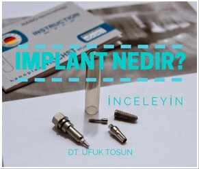 implant nedir