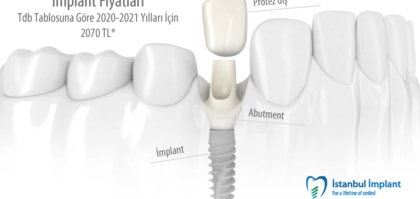 implant fiyatları